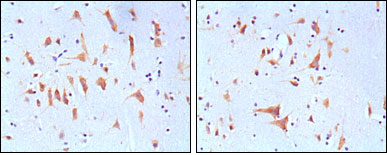 FMR1 / FMRP Antibody - IHC of paraffin-embedded human brain tissues, showing cytoplasmic localization with DAB staining using FMR1 mouse monoclonal antibody.