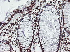 FMR1 / FMRP Antibody - IHC of paraffin-embedded Human colon tissue using anti-FMR1 mouse monoclonal antibody.