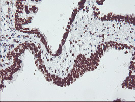 FMR1 / FMRP Antibody - IHC of paraffin-embedded Human prostate tissue using anti-FMR1 mouse monoclonal antibody.