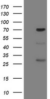 FMR1 / FMRP Antibody - HEK293T cells were transfected with the pCMV6-ENTRY control (Left lane) or pCMV6-ENTRY FMR1 (Right lane) cDNA for 48 hrs and lysed. Equivalent amounts of cell lysates (5 ug per lane) were separated by SDS-PAGE and immunoblotted with anti-FMR1.