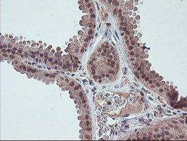 FMR1 / FMRP Antibody - IHC of paraffin-embedded Human breast tissue using anti-FMR1 mouse monoclonal antibody.
