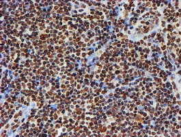 FMR1 / FMRP Antibody - IHC of paraffin-embedded Human lymphoma tissue using anti-FMR1 mouse monoclonal antibody.