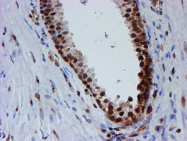 FMR1 / FMRP Antibody - IHC of paraffin-embedded Human prostate tissue using anti-FMR1 mouse monoclonal antibody.