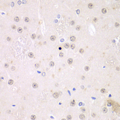 FMR1 / FMRP Antibody - Immunohistochemistry of paraffin-embedded rat brain tissue.