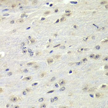 FMR1 / FMRP Antibody - Immunohistochemistry of paraffin-embedded mouse brain tissue.