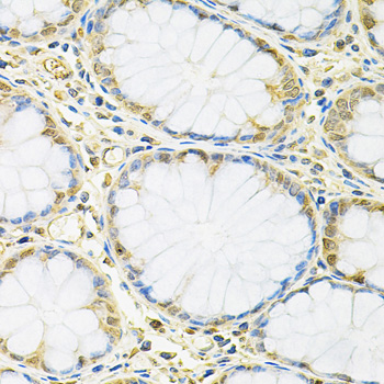 FMR1 / FMRP Antibody - Immunohistochemistry of paraffin-embedded human colon tissue.