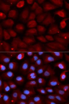 FMR1 / FMRP Antibody - Immunofluorescence analysis of U2OS cells.