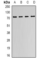 FMR1 / FMRP Antibody - Western blot analysis of FMR1 expression in MCF7 (A); Jurkat (B); mouse kidney (C); mouse liver (D) whole cell lysates.