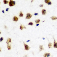 FMR1 / FMRP Antibody - Immunohistochemical analysis of FMR1 staining in rat brain formalin fixed paraffin embedded tissue section. The section was pre-treated using heat mediated antigen retrieval with sodium citrate buffer (pH 6.0). The section was then incubated with the antibody at room temperature and detected using an HRP conjugated compact polymer system. DAB was used as the chromogen. The section was then counterstained with hematoxylin and mounted with DPX.