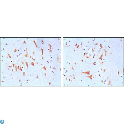 FMR1 / FMRP Antibody - Immunohistochemistry (IHC) analysis of paraffin-embedded Human Brain tissues, showing cytoplasmic localization with DAB staining using FMR1 Monoclonal Antibody.