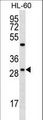 FMR1NB Antibody - FMR1NB Antibody western blot of HL-60 cell line lysates (35 ug/lane). The FMR1NB antibody detected the FMR1NB protein (arrow).