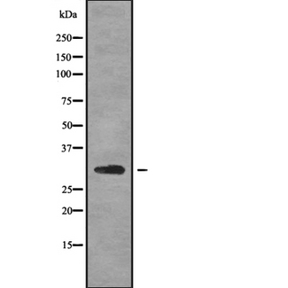 FMR1NB Antibody - Western blot analysis FMR1NB using HuvEc whole cells lysates