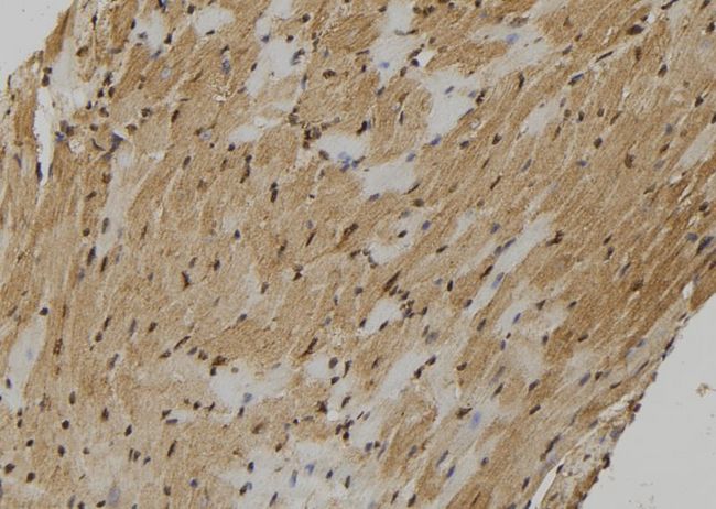 FMR1NB Antibody - 1:100 staining mouse heart tissue by IHC-P. The sample was formaldehyde fixed and a heat mediated antigen retrieval step in citrate buffer was performed. The sample was then blocked and incubated with the antibody for 1.5 hours at 22°C. An HRP conjugated goat anti-rabbit antibody was used as the secondary.