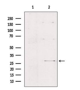 FMR1NB Antibody - Western blot analysis of extracts of HepG2 cells using FMR1NB antibody. Lane 1 was treated with the blocking peptide.