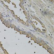 FMR1NB Antibody - Immunohistochemistry of paraffin-embedded Human prostate using FMR1NB Polyclonal Antibody at dilution of 1:100 (40x lens).