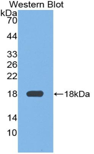 FN1 / Fibronectin Antibody - Western blot of recombinant FN1 / Fibronectin.  This image was taken for the unconjugated form of this product. Other forms have not been tested.