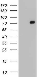FN1 / Fibronectin Antibody - HEK293T cells were transfected with the pCMV6-ENTRY control (Left lane) or pCMV6-ENTRY FN1 (Right lane) cDNA for 48 hrs and lysed. Equivalent amounts of cell lysates (5 ug per lane) were separated by SDS-PAGE and immunoblotted with anti-FN1.