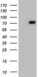 FN1 / Fibronectin Antibody - HEK293T cells were transfected with the pCMV6-ENTRY control (Left lane) or pCMV6-ENTRY FN1 (Right lane) cDNA for 48 hrs and lysed. Equivalent amounts of cell lysates (5 ug per lane) were separated by SDS-PAGE and immunoblotted with anti-FN1.