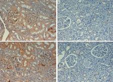 FN1 / Fibronectin Antibody - Immunohistochemistry with rabbit anti fibronectin biotin conjugated at 20X with negative controls (right). Tissue: kidney. Fixation: FFPE buffered formalin 10% conc. Antigen retrieval: Heat, Citrate pH 6.2. Pressure Cooker (top) or EDTA pH 9.5 Pressure Cooker (bottom). Primary antibody: 2 ug/ml for 1 hour @ room T. Secondary antibody: Streptavidin. Conj. HRP 10 ug/ml circa 45 min. @ room T. Staining: antibody as precipitated red signal with a hematoxylin purple nuclear counterstain. This image was taken for the unconjugated form of this product. Other forms have not been tested.