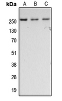 FN1 / Fibronectin Antibody - Western blot analysis of Fibronectin expression in HeLa (A); SP2/0 (B); rat lung (C) whole cell lysates.