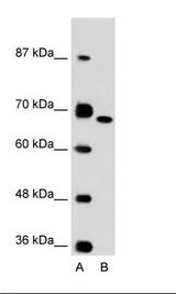 FN1 / Fibronectin Antibody - A: Marker, B: Jurkat Cell Lysate.  This image was taken for the unconjugated form of this product. Other forms have not been tested.