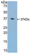 FN1 / Fibronectin Antibody