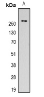 FN1 / Fibronectin Antibody - Western blot analysis of Fibronectin expression in HeLa (A) whole cell lysates.