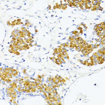 FN1 / Fibronectin Antibody - Immunohistochemistry of paraffin-embedded rat ovary using FN1 antibody at dilution of 1:100 (40x lens).