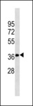 FN3K / Fructosamine-3-Kinase Antibody - FN3K Antibody western blot of K562 cell line lysates (35 ug/lane). The FN3K antibody detected the FN3K protein (arrow).