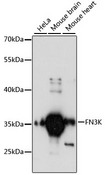 FN3K / Fructosamine-3-Kinase Antibody - Western blot analysis of extracts of various cell lines, using FN3K antibody at 1:3000 dilution. The secondary antibody used was an HRP Goat Anti-Rabbit IgG (H+L) at 1:10000 dilution. Lysates were loaded 25ug per lane and 3% nonfat dry milk in TBST was used for blocking. An ECL Kit was used for detection and the exposure time was 90s.