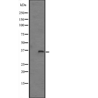 FN3K / Fructosamine-3-Kinase Antibody - Western blot analysis of FN3K expression in HepG2 cells lysate. The lane on the left is treated with the antigen-specific peptide.
