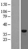 FN3K / Fructosamine-3-Kinase Protein - Western validation with an anti-DDK antibody * L: Control HEK293 lysate R: Over-expression lysate