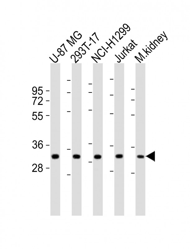 FN3KL / FN3KRP Antibody - All lanes : Anti-FN3KRP Antibody at 1:1000-1:2000 dilution Lane 1: U-87 MG whole cell lysates Lane 2: 293T-17 whole cell lysates Lane 3: NCI-H1299 whole cell lysates Lane 4: Jurkat whole cell lysates Lane 5: mouse kidney lysates Lysates/proteins at 20 ug per lane. Secondary Goat Anti-Rabbit IgG, (H+L), Peroxidase conjugated at 1/10000 dilution Predicted band size : 34 kDa Blocking/Dilution buffer: 5% NFDM/TBST.