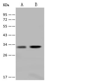FN3KL / FN3KRP Antibody - Anti-FN3KRP rabbit polyclonal antibody at 1:500 dilution. Lane A: U87MG Whole Cell Lysate. Lane B: Jurkat Whole Cell Lysate. Lysates/proteins at 30 ug per lane. Secondary: Goat Anti-Rabbit IgG (H+L)/HRP at 1/10000 dilution. Developed using the ECL technique. Performed under reducing conditions. Predicted band size: 34 kDa. Observed band size: 33 kDa.