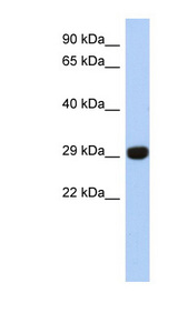 FN3KL / FN3KRP Antibody - FN3KRP antibody Western blot of Jurkat lysate. This image was taken for the unconjugated form of this product. Other forms have not been tested.