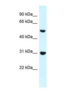 FNBP1 / FBP17 Antibody - FNBP1 antibody Western blot of Mouse Pancreas lysate. Antibody concentration 1 ug/ml.  This image was taken for the unconjugated form of this product. Other forms have not been tested.