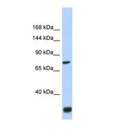 FNDC3A Antibody - Western blot of Human Fetal Brain. FNDC3A antibody dilution 1.0 ug/ml.  This image was taken for the unconjugated form of this product. Other forms have not been tested.