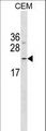 FNDC4 Antibody - FNDC4 Antibody western blot of CEM cell line lysates (35 ug/lane). The FNDC4 antibody detected the FNDC4 protein (arrow).