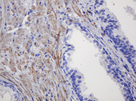 FNDC4 Antibody - IHC of paraffin-embedded Human prostate tissue using anti-FNDC4 mouse monoclonal antibody.