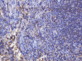 FNDC4 Antibody - IHC of paraffin-embedded Human lymph node tissue using anti-FNDC4 mouse monoclonal antibody.
