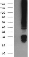 FNDC4 Antibody - HEK293T cells were transfected with the pCMV6-ENTRY control (Left lane) or pCMV6-ENTRY FNDC4 (Right lane) cDNA for 48 hrs and lysed. Equivalent amounts of cell lysates (5 ug per lane) were separated by SDS-PAGE and immunoblotted with anti-FNDC4.