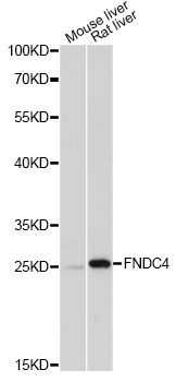 FNDC4 Antibody - Western blot analysis of extracts of various cell lines, using FNDC4 antibody at 1:1000 dilution. The secondary antibody used was an HRP Goat Anti-Rabbit IgG (H+L) at 1:10000 dilution. Lysates were loaded 25ug per lane and 3% nonfat dry milk in TBST was used for blocking. An ECL Kit was used for detection and the exposure time was 90s.
