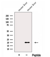 FNDC5 / Irisin Antibody - Western blot analysis of extracts of mouse liver tissue using FNDC5 antibody. The lane on the left was treated with blocking peptide.