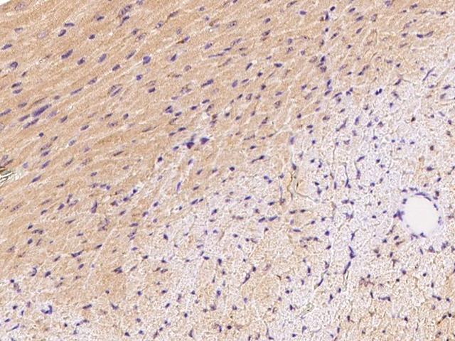 FNDC5 / Irisin Antibody - Immunochemical staining FNDC5 in mouse heart with rabbit polyclonal antibody at 1:1000 dilution, formalin-fixed paraffin embedded sections.