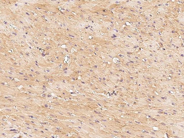 FNDC5 / Irisin Antibody - Immunochemical staining FNDC5 in rat heart with rabbit polyclonal antibody at 1:1000 dilution, formalin-fixed paraffin embedded sections.