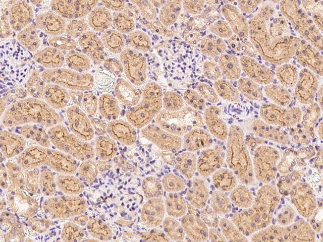 FNDC5 / Irisin Antibody - Immunochemical staining FNDC5 in rat kidney with rabbit polyclonal antibody at 1:1000 dilution, formalin-fixed paraffin embedded sections.