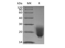 FNDC5 / Irisin Protein - Recombinant Human/Mouse/Rat Irisin/FNDC5 (N-6His)
