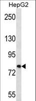 FNDC7 Antibody - FNDC7 Antibody western blot of HepG2 cell line lysates (35 ug/lane). The FNDC7 antibody detected the FNDC7 protein (arrow).