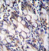 FNDC7 Antibody - FNDC7 Antibody immunohistochemistry of formalin-fixed and paraffin-embedded human rectum tissue followed by peroxidase-conjugated secondary antibody and DAB staining.
