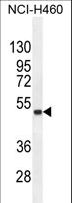 FNDC8 Antibody - FNDC8 Antibody western blot of NCI-H460 cell line lysates (35 ug/lane). The FNDC8 antibody detected the FNDC8 protein (arrow).
